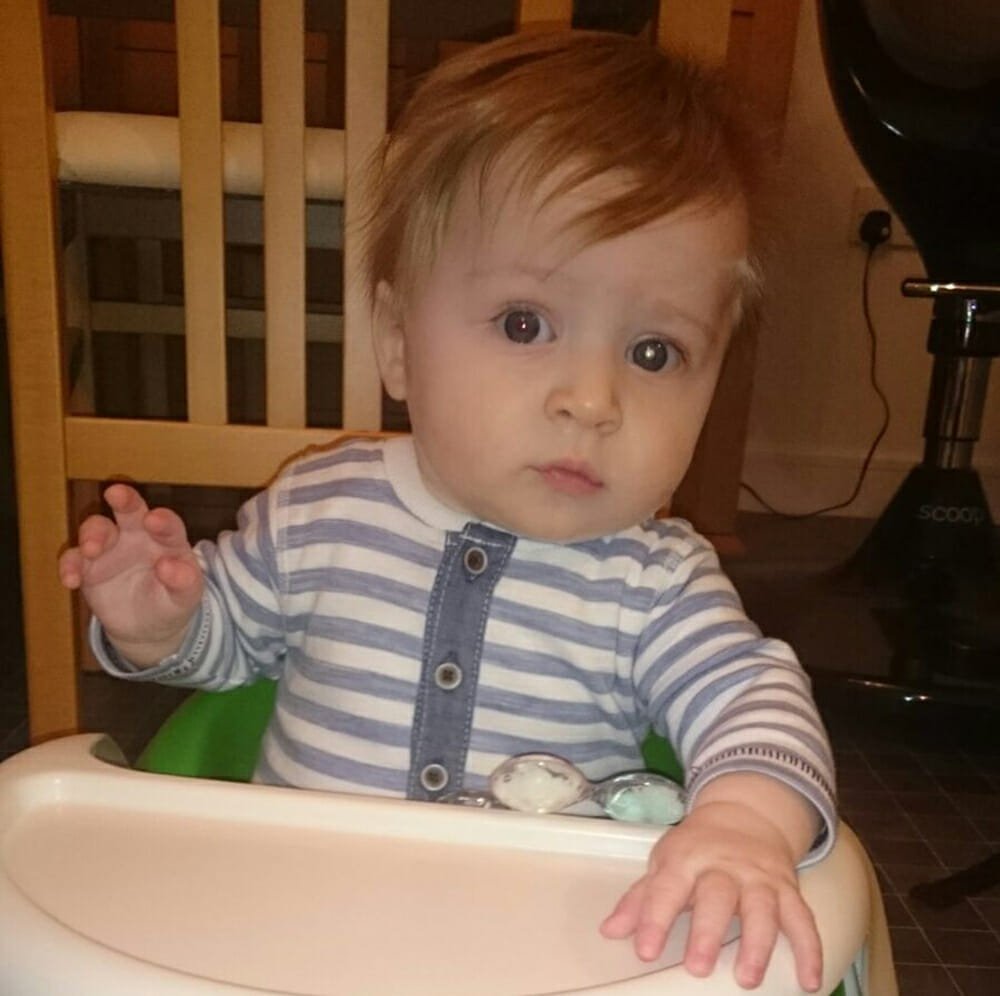 CHECT photo - picture showing the white glow in Charlie's eye