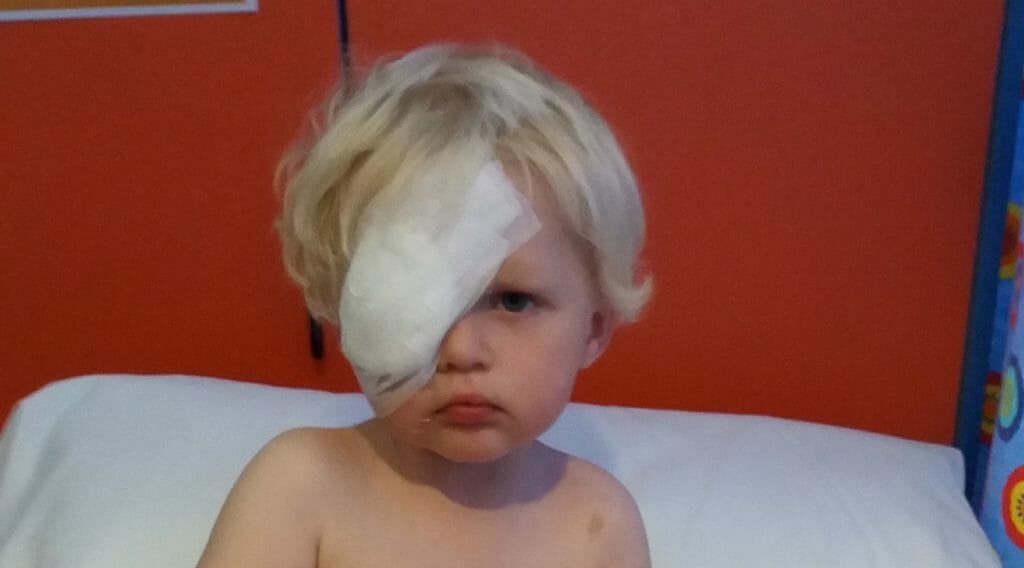 CHECT Photo - Ethan after surgery