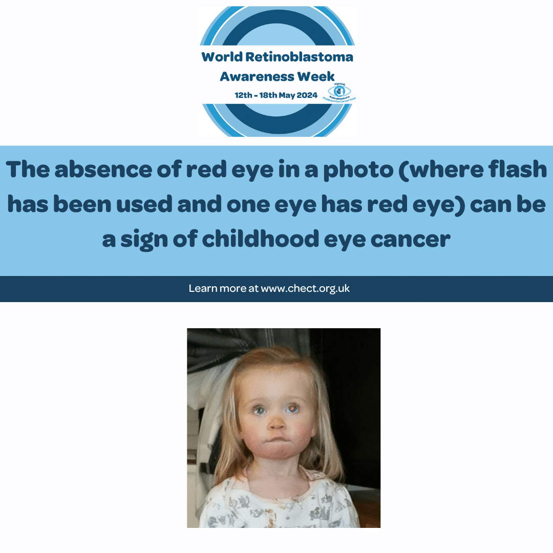 the text reads The absence of a red eye in a photo (where flash has been used and one eye has red eye) can be a sign of childhood eye cancer