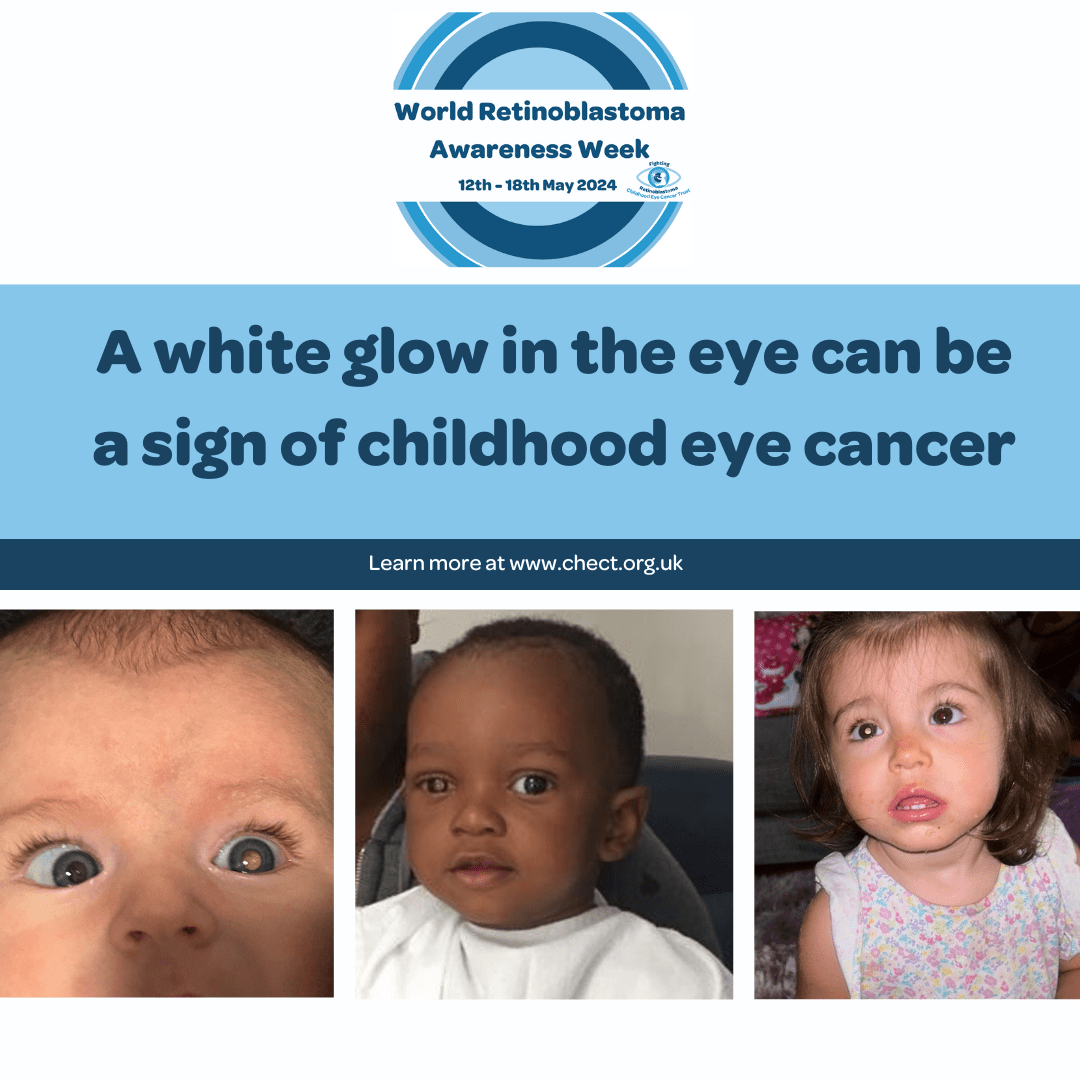 the text reads A white glow in the eye can be a sign of childhood eye cancer