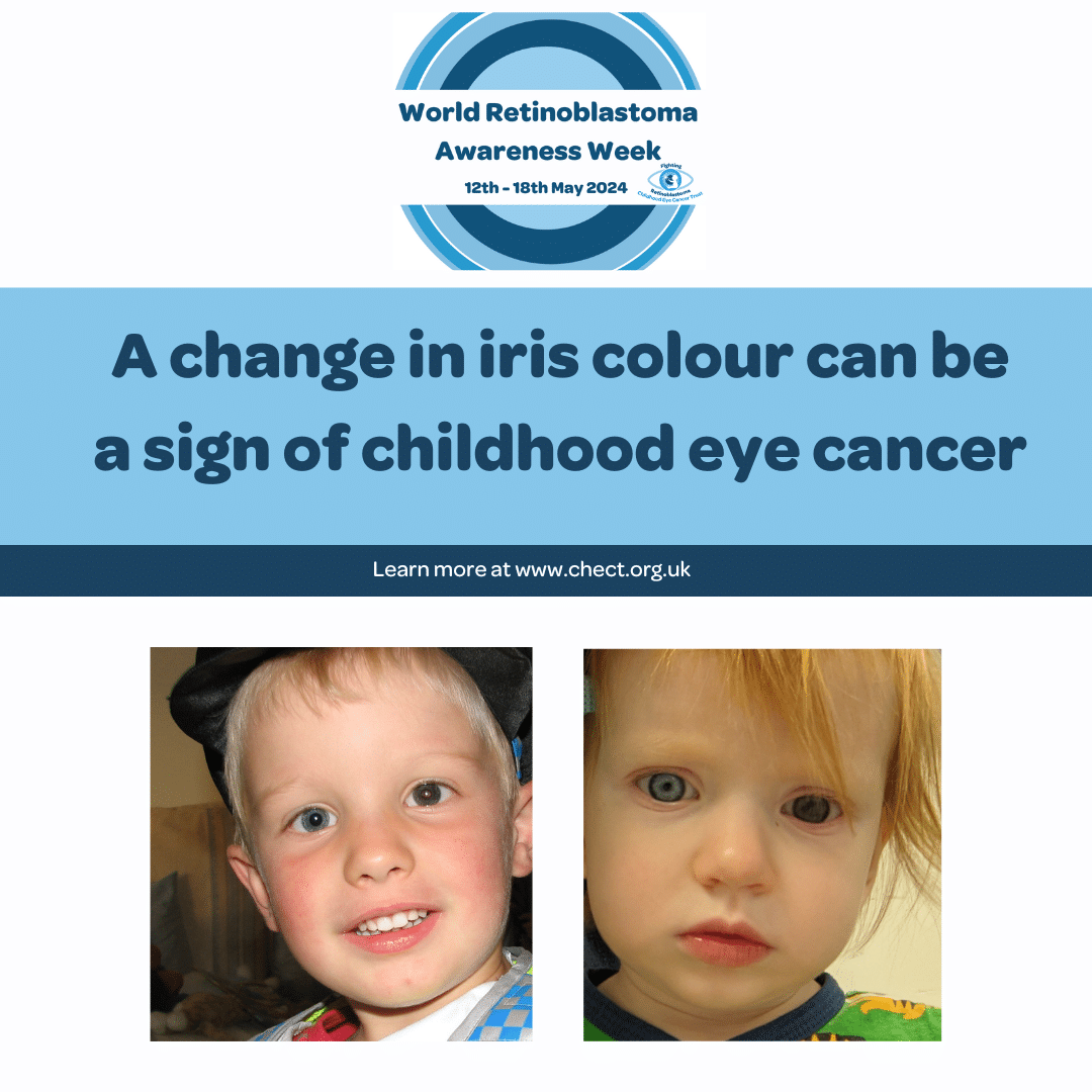 text reads a change in iris colour can be a sign of childhood eye cancer