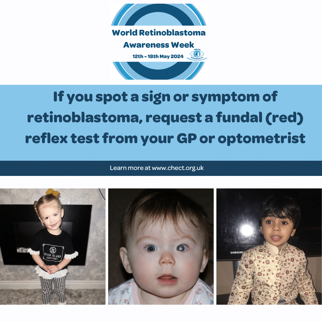 If you spot a sign or symptom of retinoblastoma, request a fundal (red) reflex test from your GP or optometrist