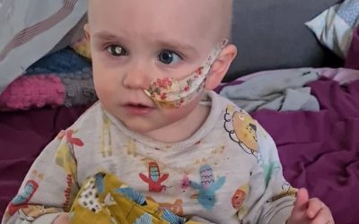 We spent our wedding night in hospital with our daughter who has eye cancer