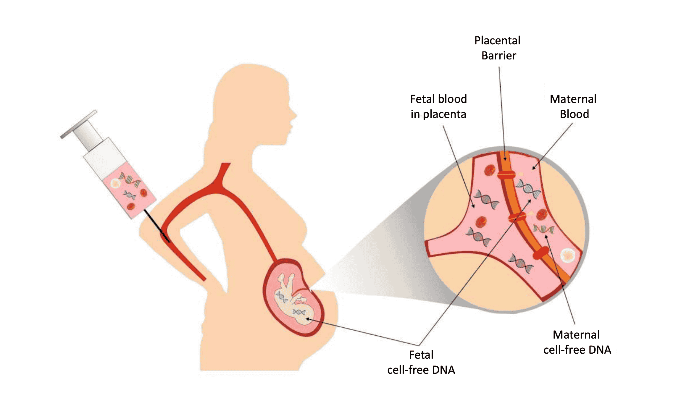 Image showing cross-section of a uterus showing fetal blood and cell-free DNA separated from maternal blood and cell-free DNA by placental barrier.