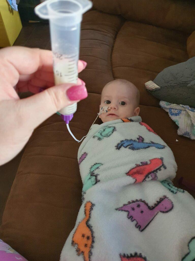 Thomas with a feeding tube