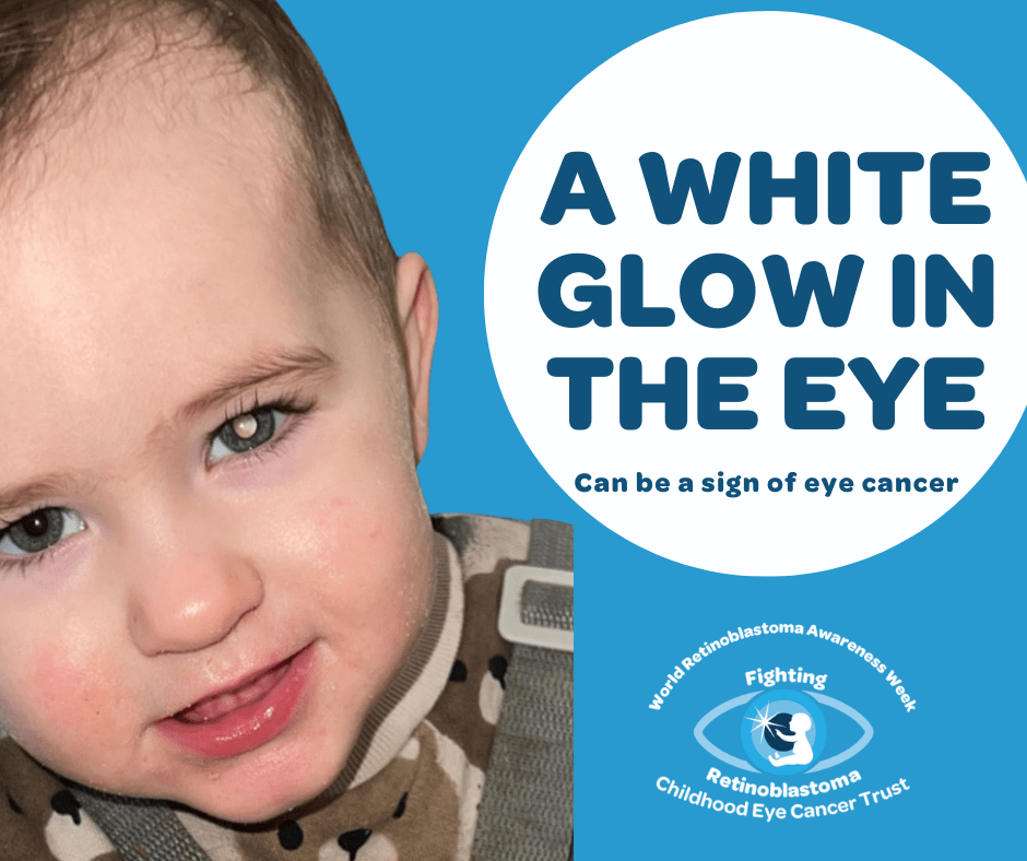 A white glow in the eye Can be a sign of eye cancer