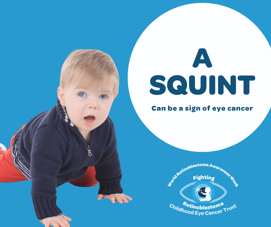 text reads 'a squint can be a sign of childhood eye cancer'