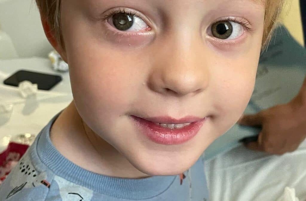 Arlo is smiling at the camera, he has a white glow in one eye - a sign of the eye cancer retinoblastoma