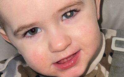 “We spotted a white glow in our son’s eye – it turned out to be cancer”