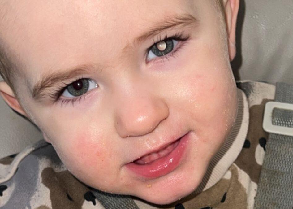 Kooper is a toddler and has a white glow in one eye