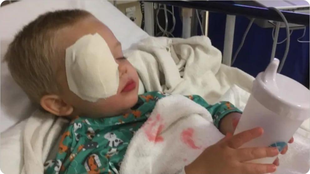 Theo is asleep with a bandage over one eye