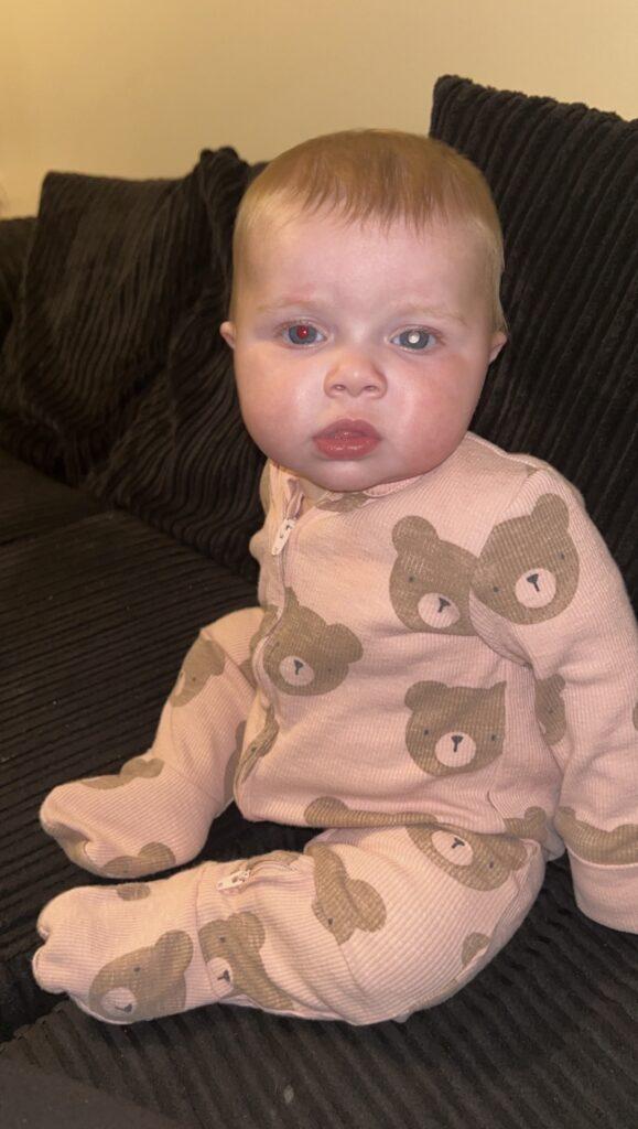 Lila is sat up on the sofa, one eye has a glow